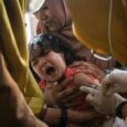 Vitamins over vaccines: misinformation entrenched amid Indonesia measles surge