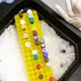 Understanding the Immune System to Predict, Prevent, and Treat Diseases