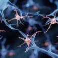 Cancer-Like Mutations Found in the Brain May Be Driving Alzheimer’s Disease