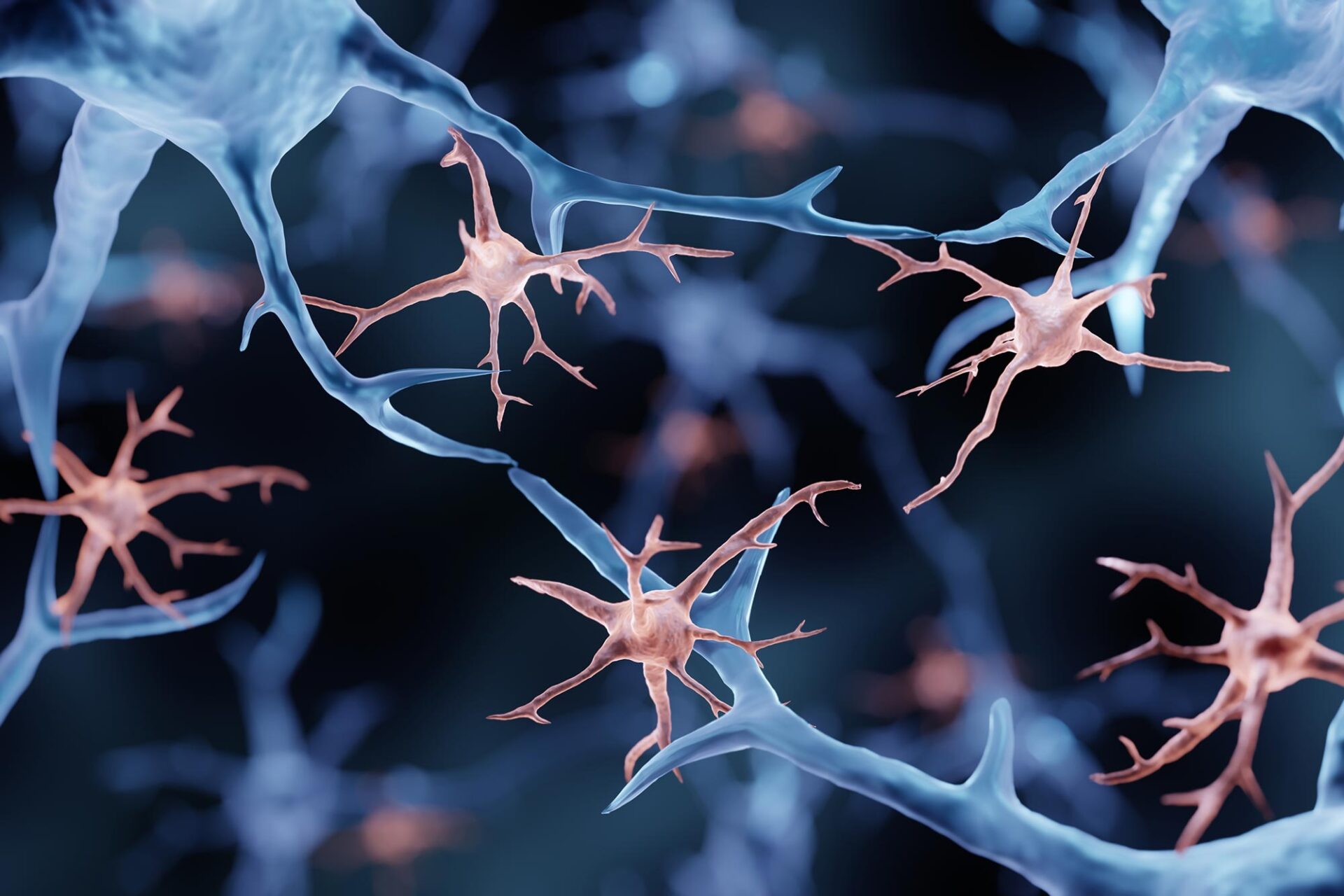 Cancer-Like Mutations Found in the Brain May Be Driving Alzheimer’s Disease