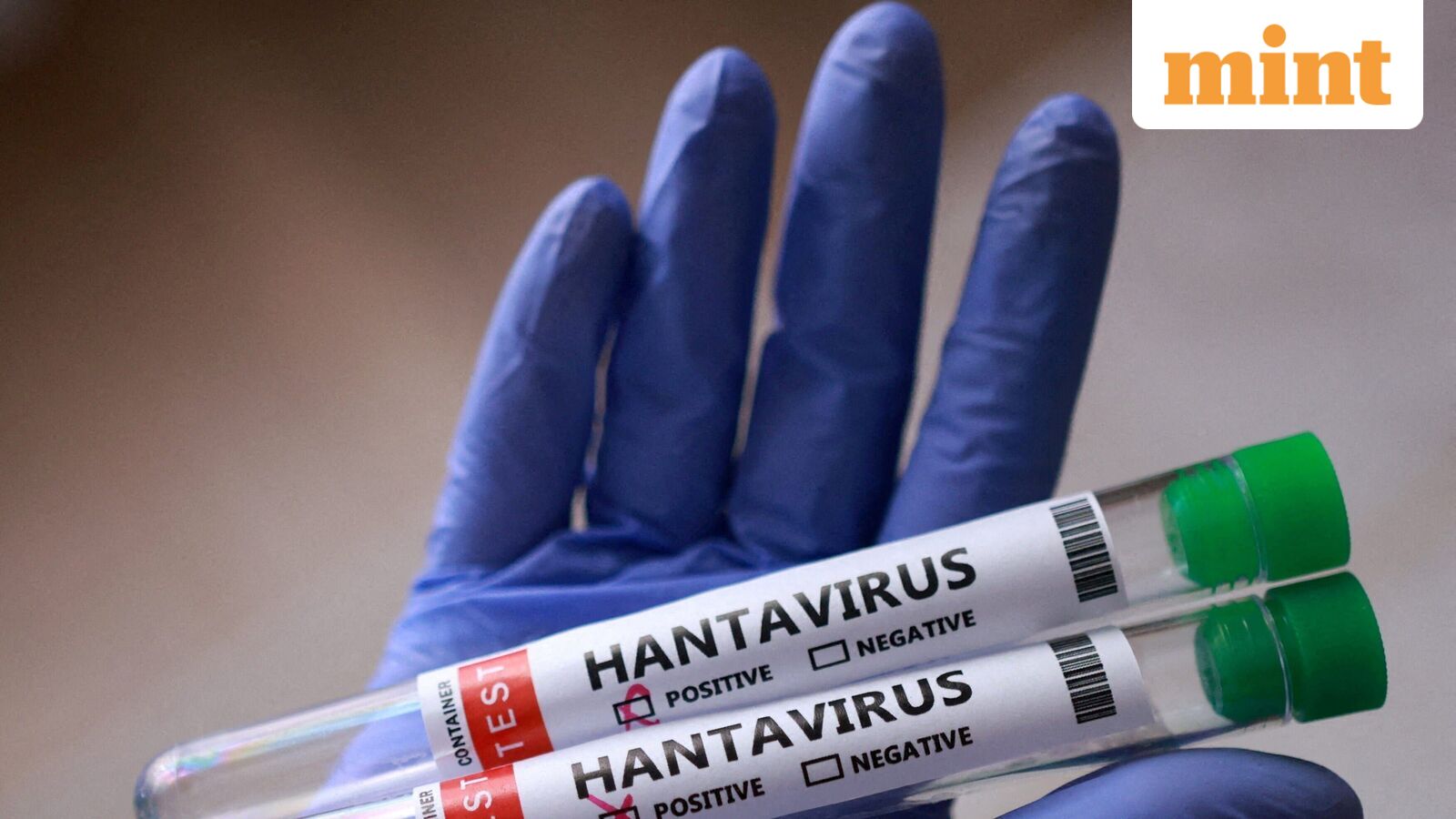 Hantavirus RNA can stay in semen for years, may offer lifelong immunity: What study reveals