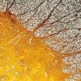 World MS Day: Immune Cell Discovery Might Explain Multiple Sclerosis at Its Worst : ScienceAlert