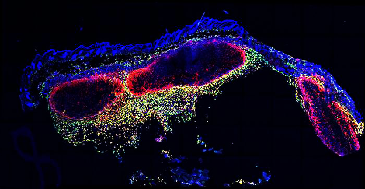 Watch Immune System Cells Gobble Up Cancer Cells
