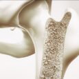 Study reveals immune differences between titanium and zirconia implants