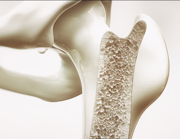 Study reveals immune differences between titanium and zirconia implants