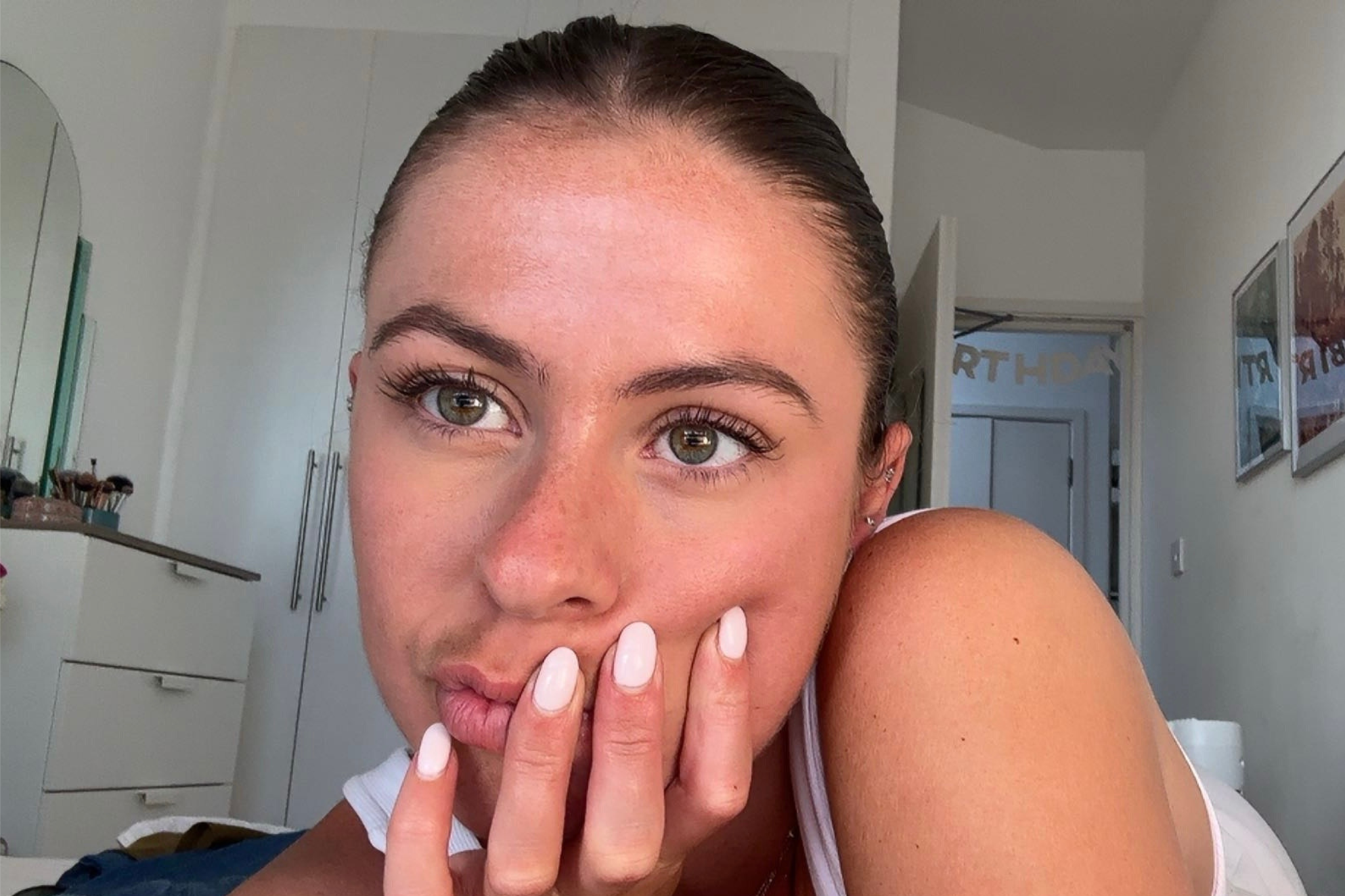 Lydia is one of many young people who’ve had Botox in their twenties