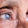 Why More Eye Specialists Are Recommending Supplements For Better Vision Health