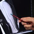 Montreal study sheds light on vitamin K’s role in bone strength