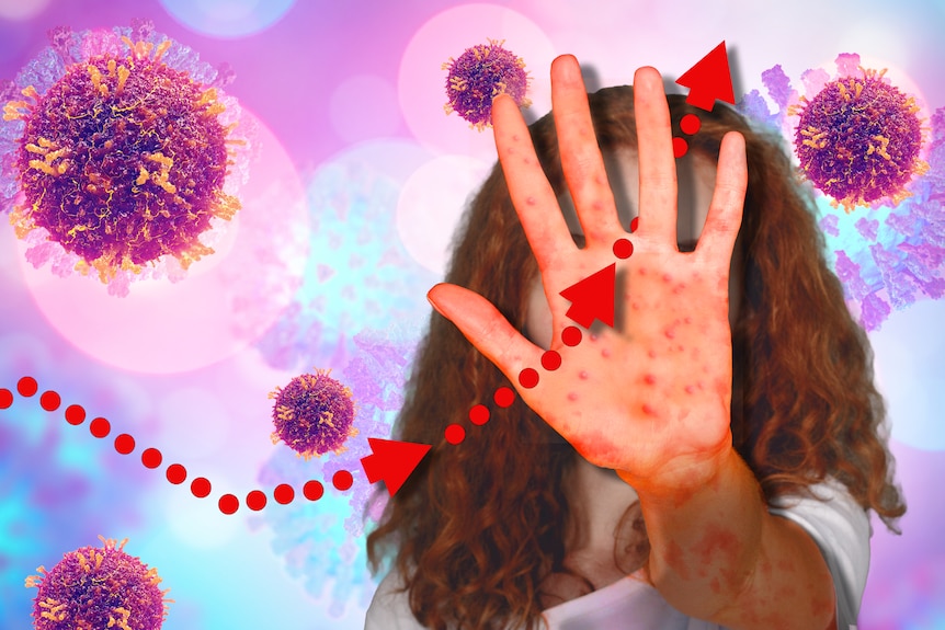 a climbing graph overlay on a person covered with measles
