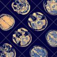 Simple amino acid supplement may help fight Alzheimer’s disease