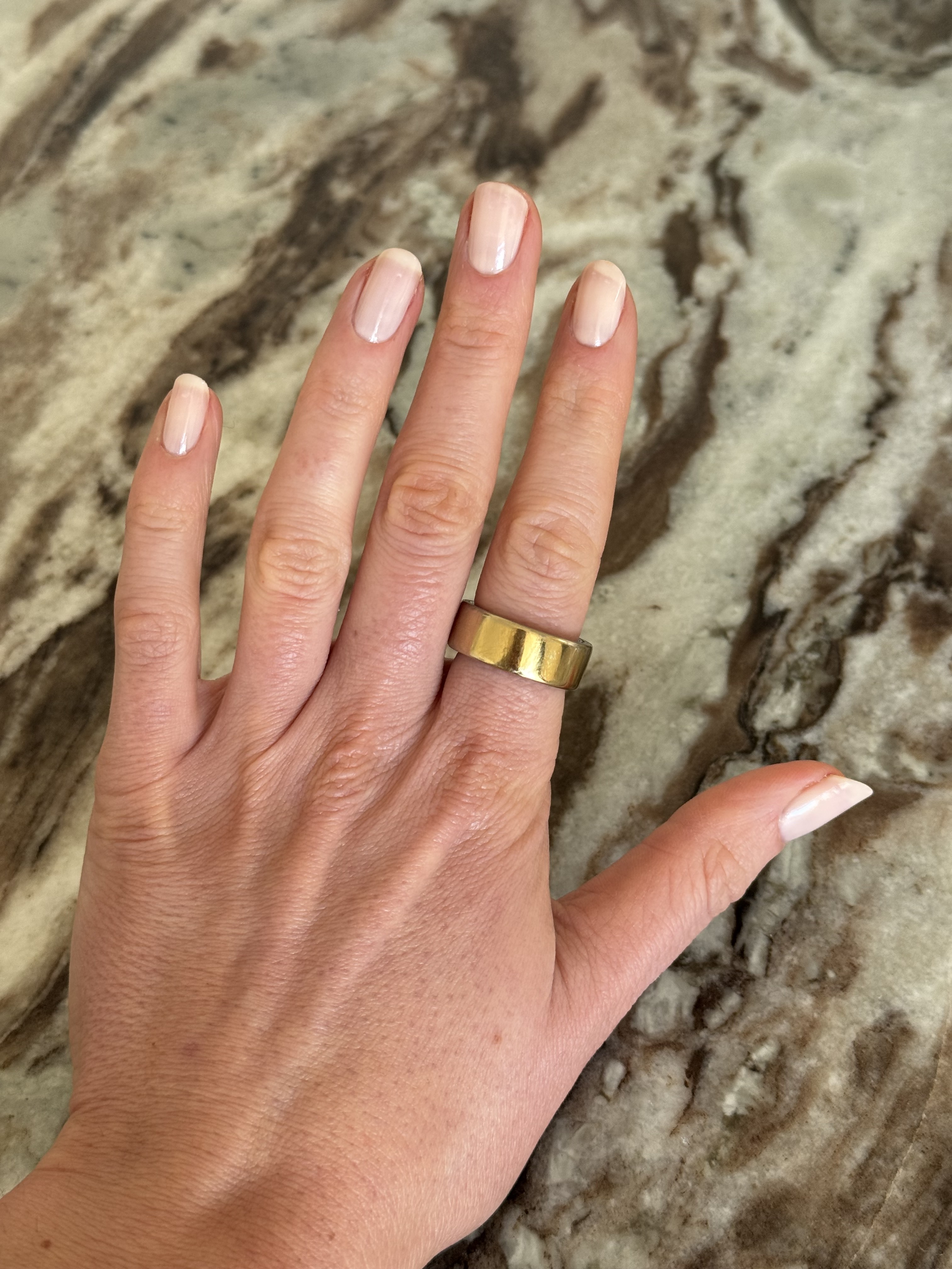 A photo of Eleanor's hand