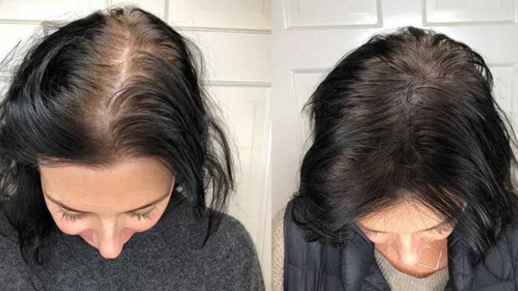 Before and after view of gray roots and darker hair after a coffee rinse for temporary gray hair coverage