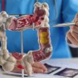Nutrition Strategies to Induce Remission in IBD