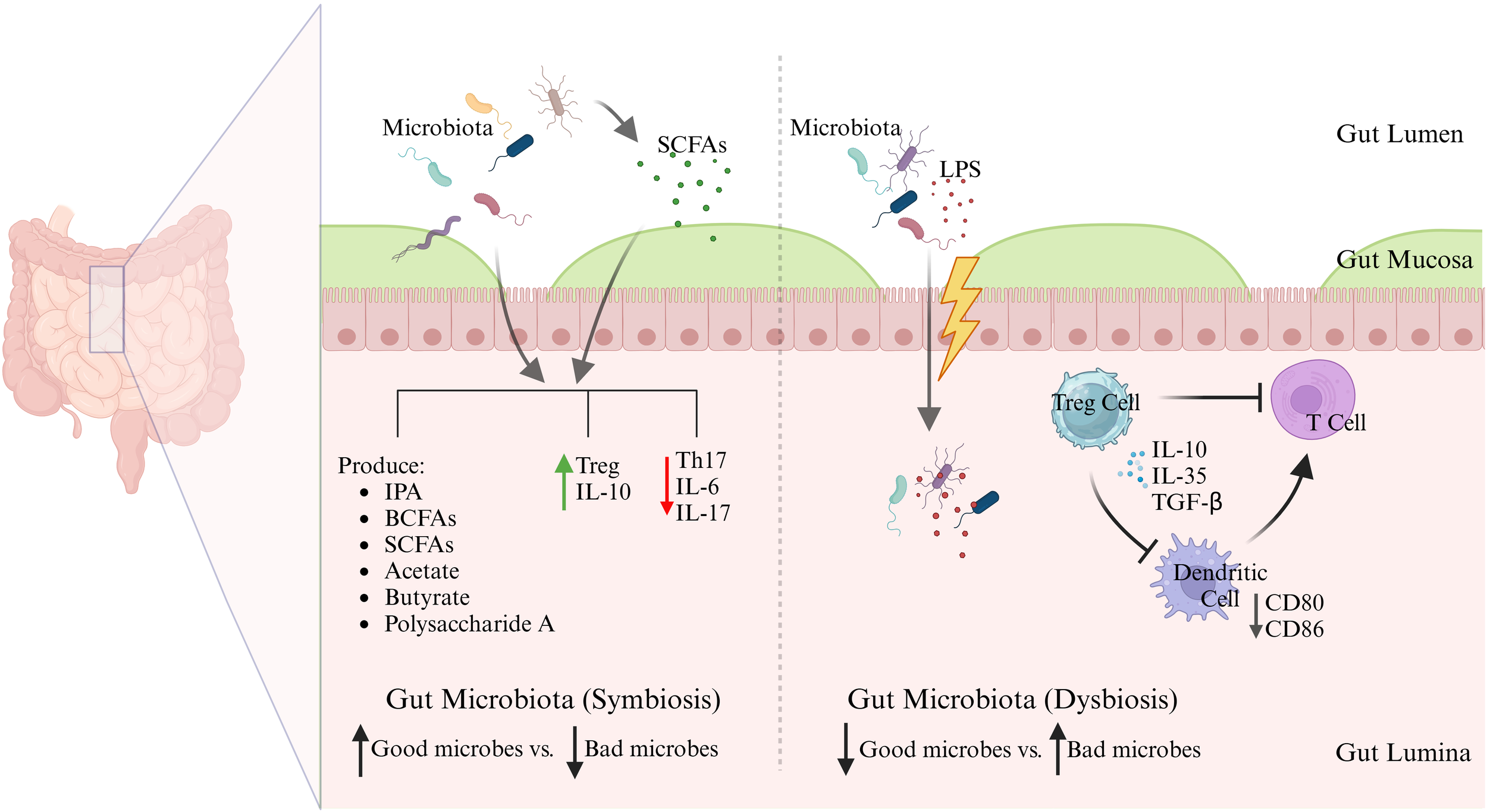 Illustration showing the relationship between gut microbiota and immune response. On the left, symbiotic microbiota in the gut produce beneficial compounds like IPA and SCFAs, increasing Treg cells and IL-10, while reducing Th17, IL-6, and IL-17. On the right, dysbiosis with harmful bacteria increases IL-6 and IL-17, disrupting immune balance. Dendritic cells interact with T cells, regulating immune responses through cytokines IL-10, IL-35, and TGF-β. The diagram highlights good versus bad microbial balance in the gut.