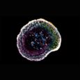 For the first time, scientists recorded in 3D the exact moment when immune system cells "kill" cancer cells.