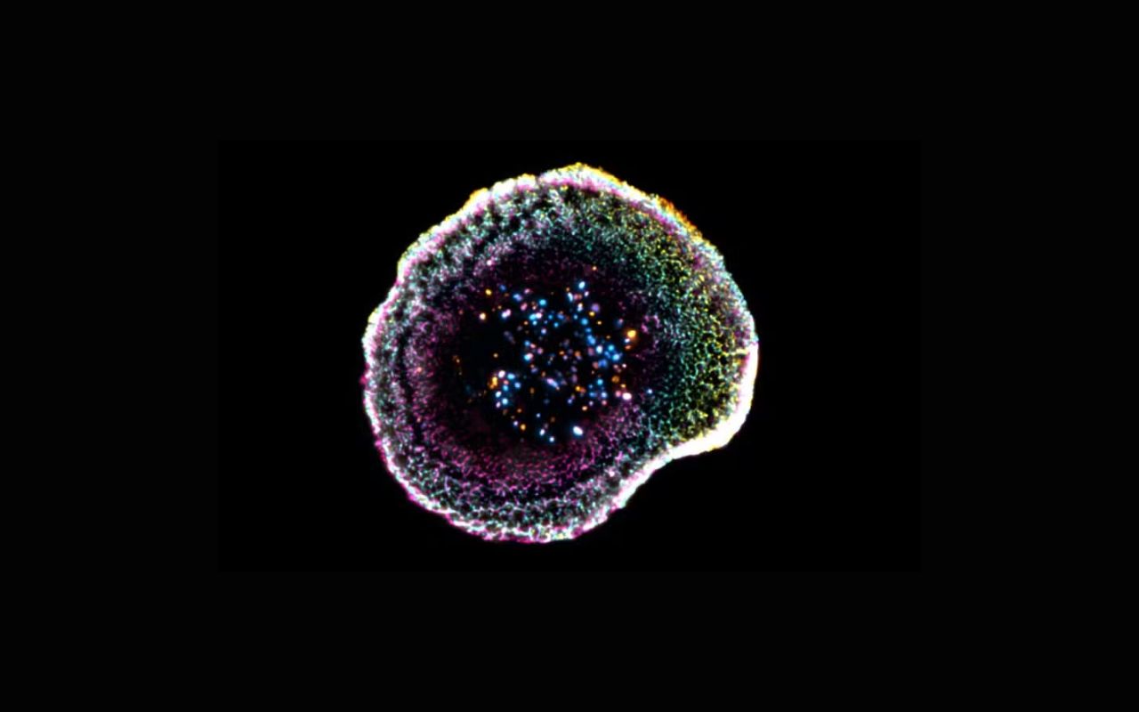 For the first time, scientists recorded in 3D the exact moment when immune system cells "kill" cancer cells.