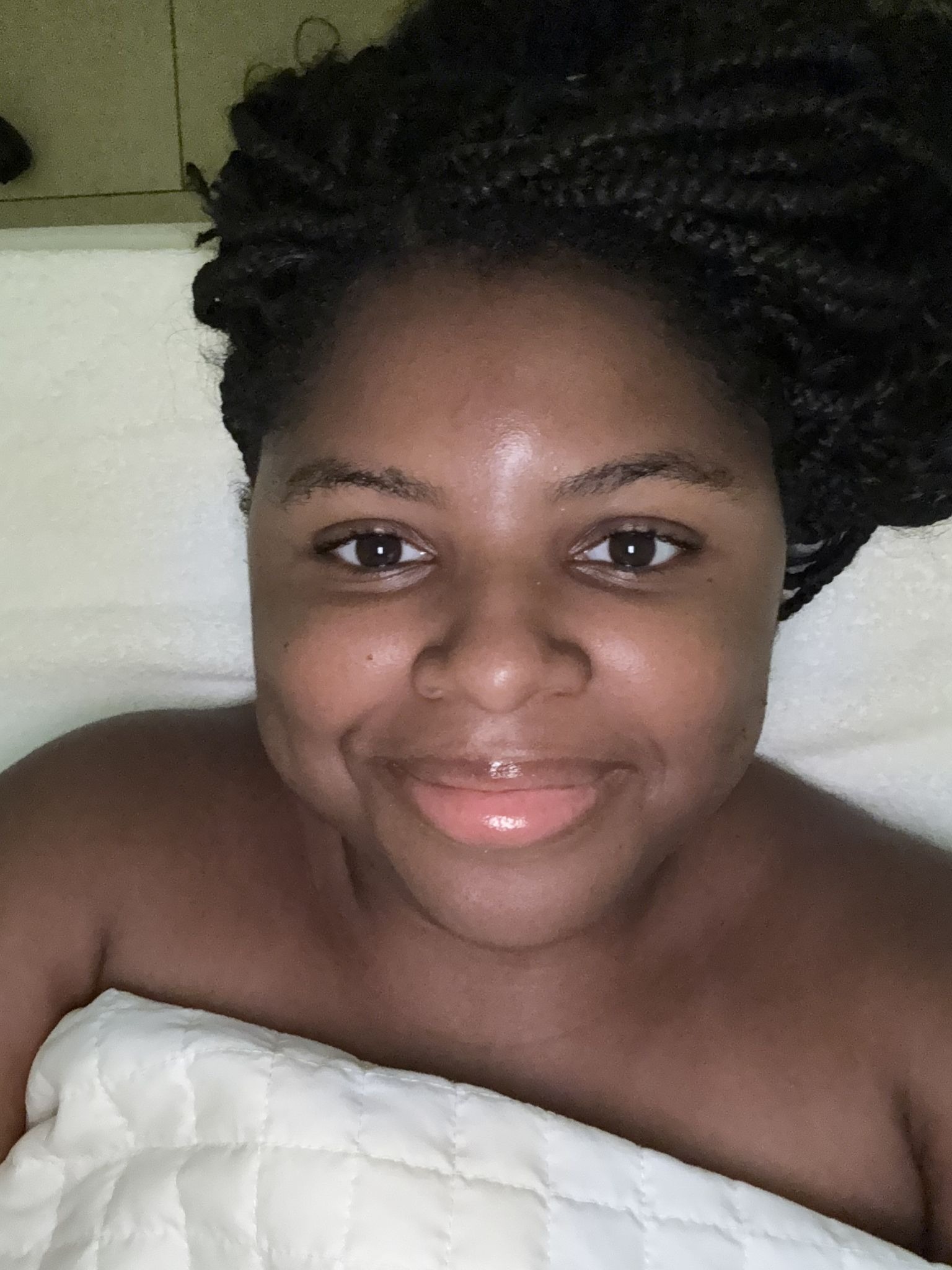 Everything A Trip To St. Lucia Taught Me About My Skin