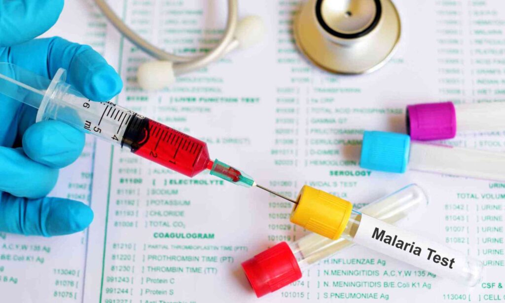 Successful Kenyan malaria study may help build stronger vaccines