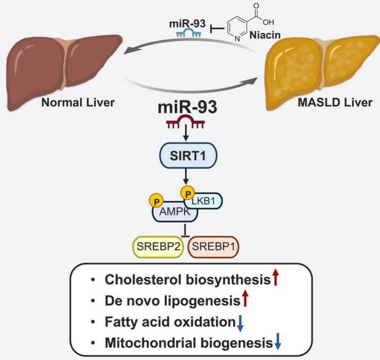 miR 93 Drives Fatty Liver Disease by Inhibiting SIRT1
