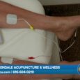Allendale Acupuncture & Wellness heals patients from neuropathy