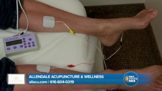 Allendale Acupuncture & Wellness heals patients from neuropathy
