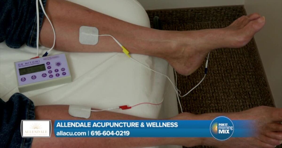 Allendale Acupuncture & Wellness heals patients from neuropathy