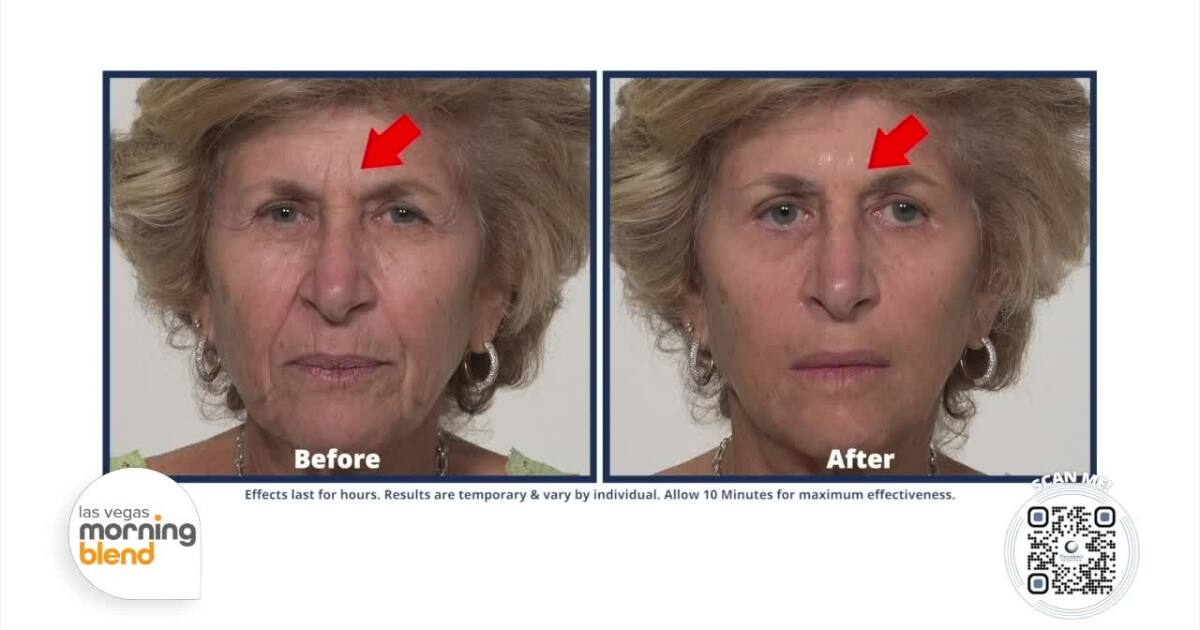 Plexaderm’s Latest Beauty Buzz Focuses on Fast Results Without the Filters