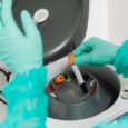 Your hair-growth vitamin could be hiding your cancer from your doctor – VegOut