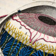 Glaucoma model links immune signaling to disease progression