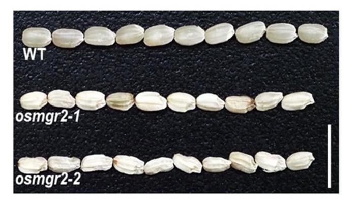 Magnesium transporter controls rice grain development and eating quality