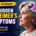 Wellness Wednesday: The hidden Alzheimer’s symptoms that don’t look like memory loss at all