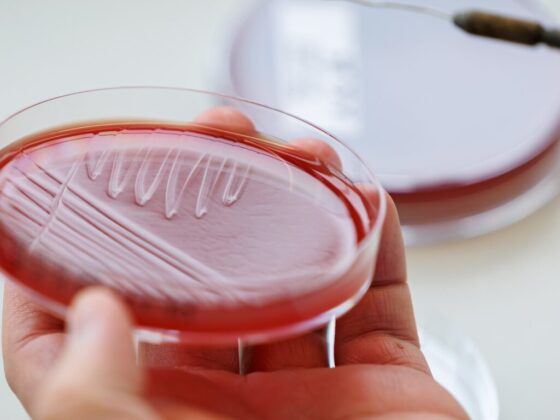 What Are Ultra-Processed Foods and What Are They Doing to Us?