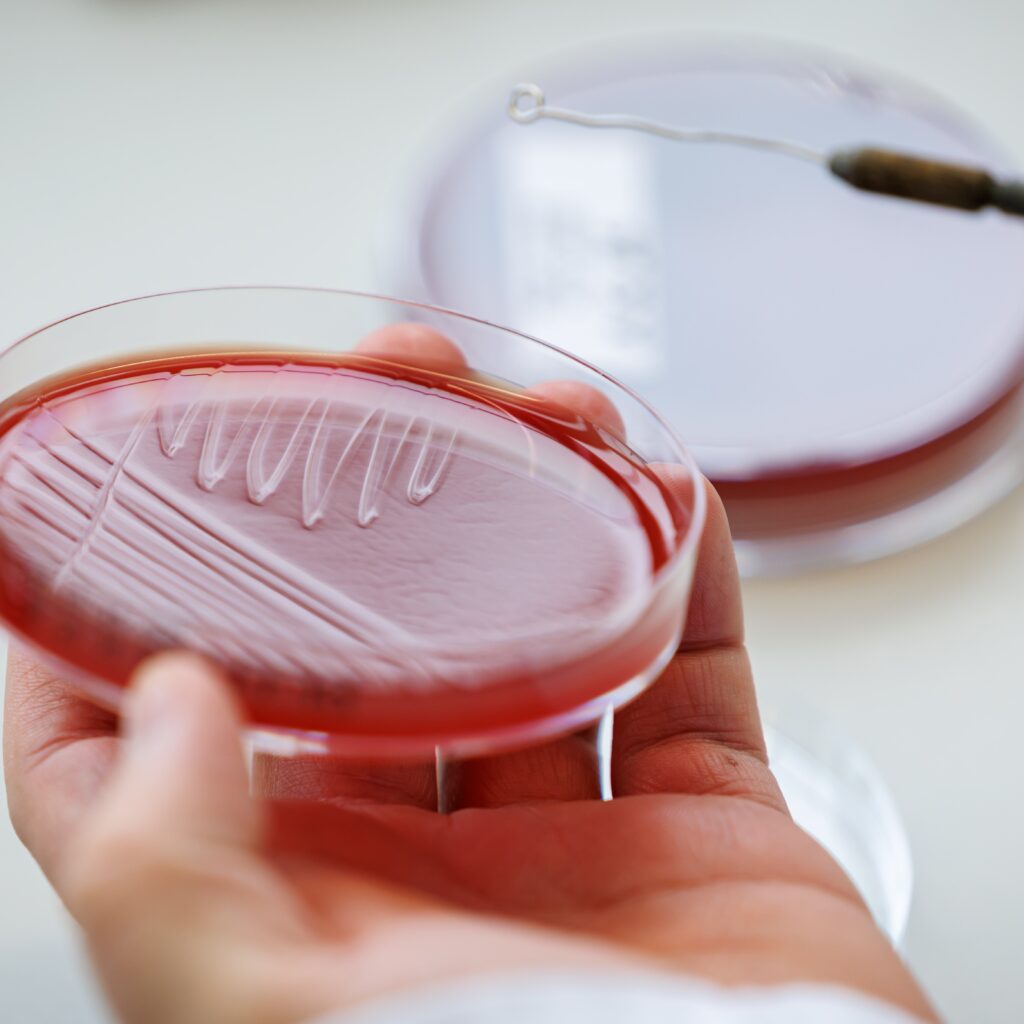 What Are Ultra-Processed Foods and What Are They Doing to Us?