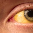 A single shot may help the immune system fight hepatitis B, and the early results are raising hopes