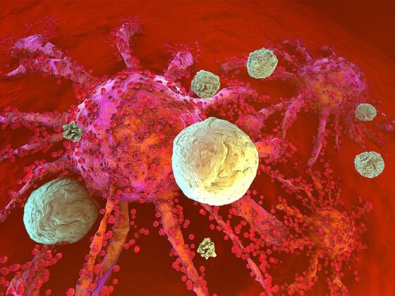 GABA signaling linked to immune resistance in some tumors