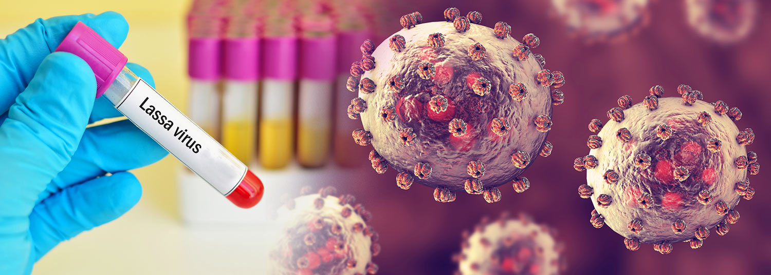 Newswise: CVD and Collaborators Launch Study to Better Understand Immune Responses to Lassa Fever